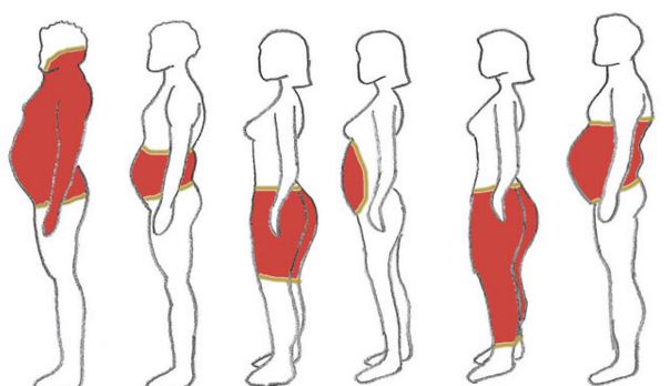 Распределение жира в теле мужчин и женщин