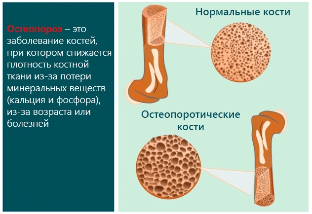 Зарядка для женщин после 40-50-60 лет утренняя на каждый день, упражнения для пожилых