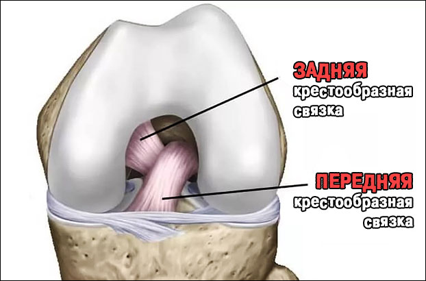 Передняя крестообразная связка