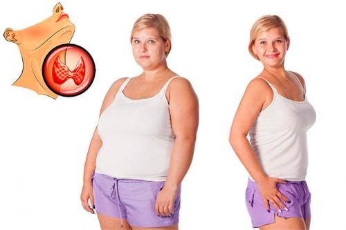 Как похудеть при гипотиреозе форум. Гипотиреоз и лишний вес