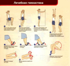 лечебная гимнастика